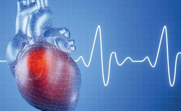 сердечная недостаточность - осложнение амилоидоза почек